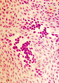 Laboratory Diagnosis Of Herpes Simplex Viruses Infection